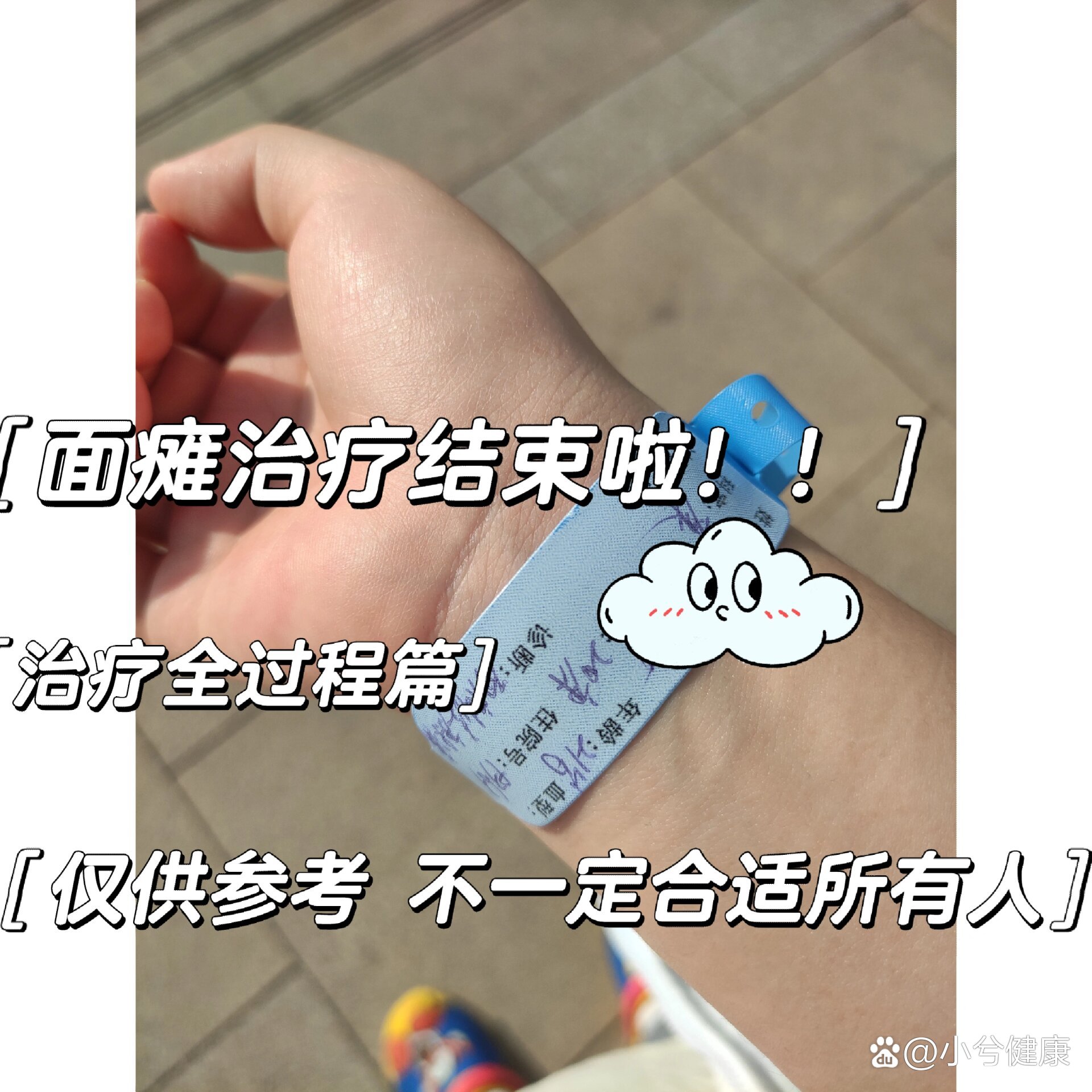 面瘫的自我治疗方法