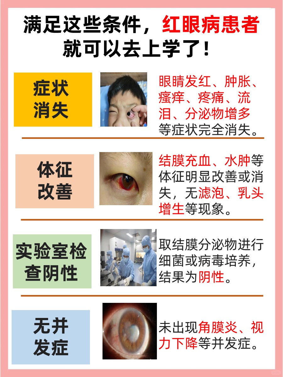 结膜炎是由什么原因引起的