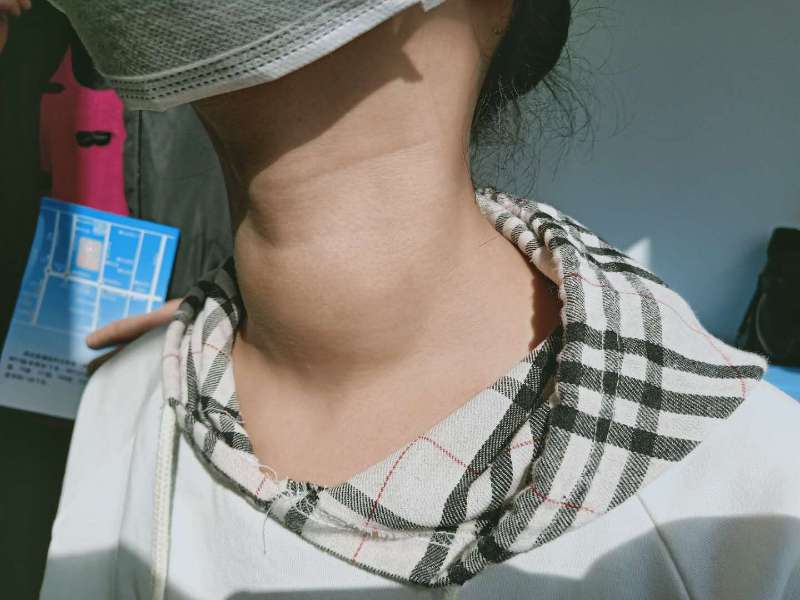 服用典131对身体有什么危害,服用后有什