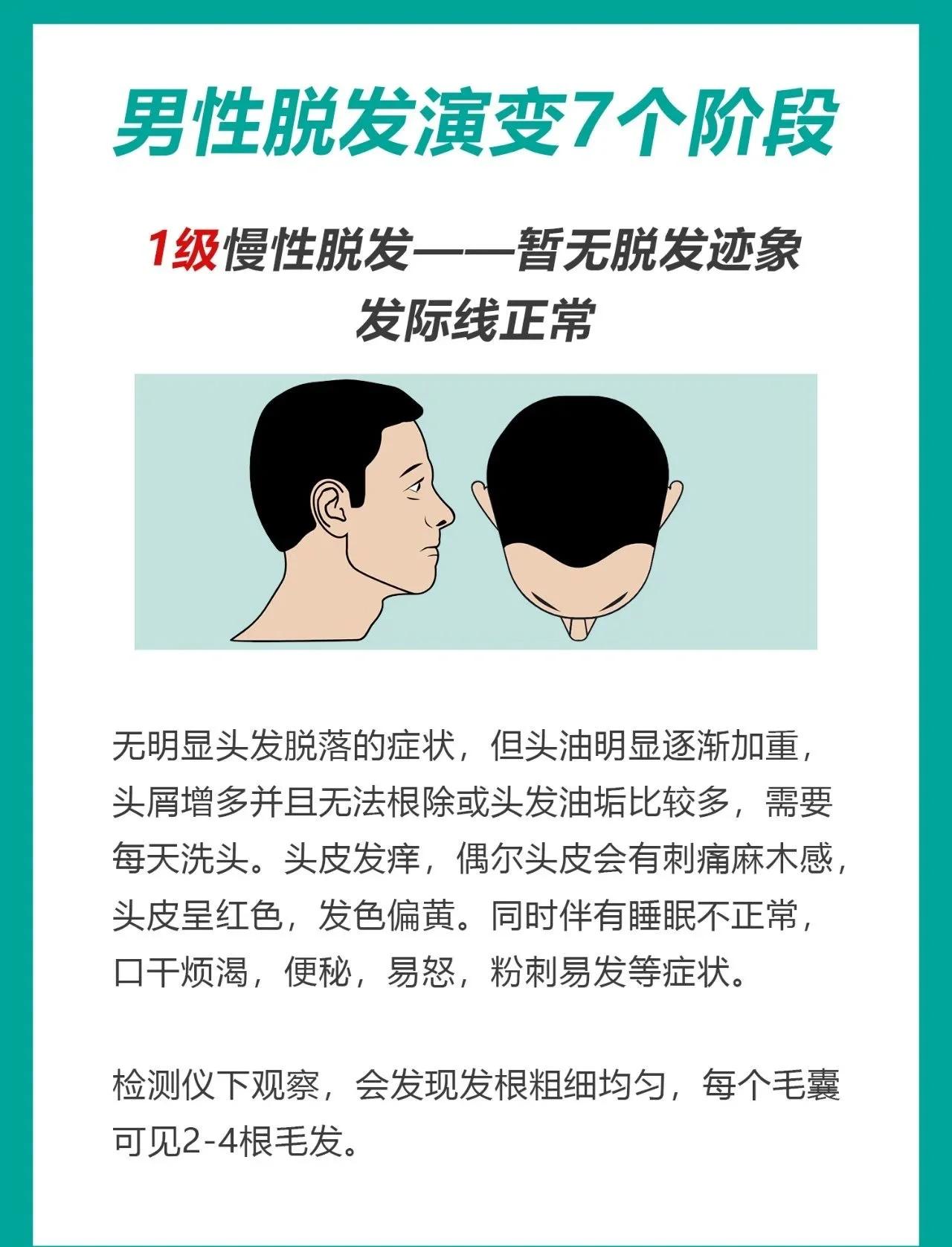 一天掉头发大概多少算正常