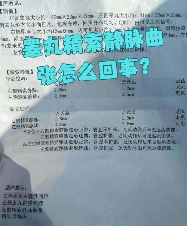 轻度精索静脉曲张可以当兵吗