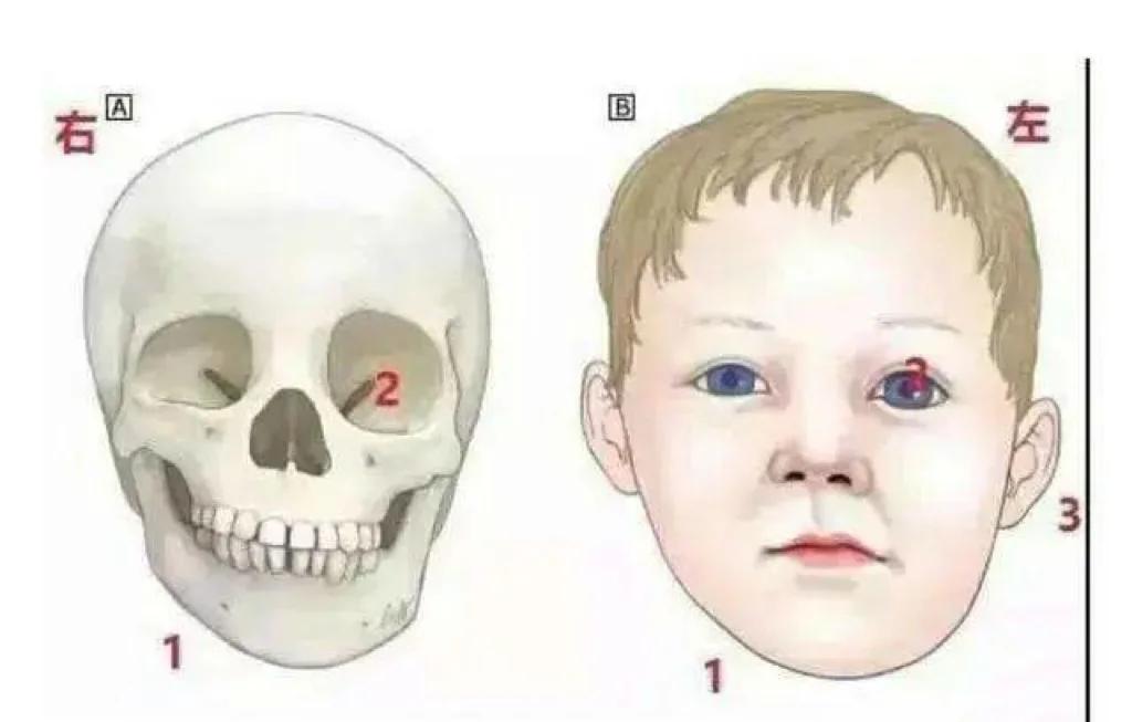 左右脸不对称怎么办?