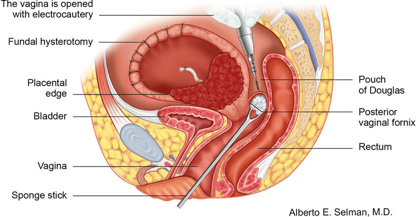 阴道疼痛,上会我在上卫生间硬被母亲脱裤子内裤分开腿