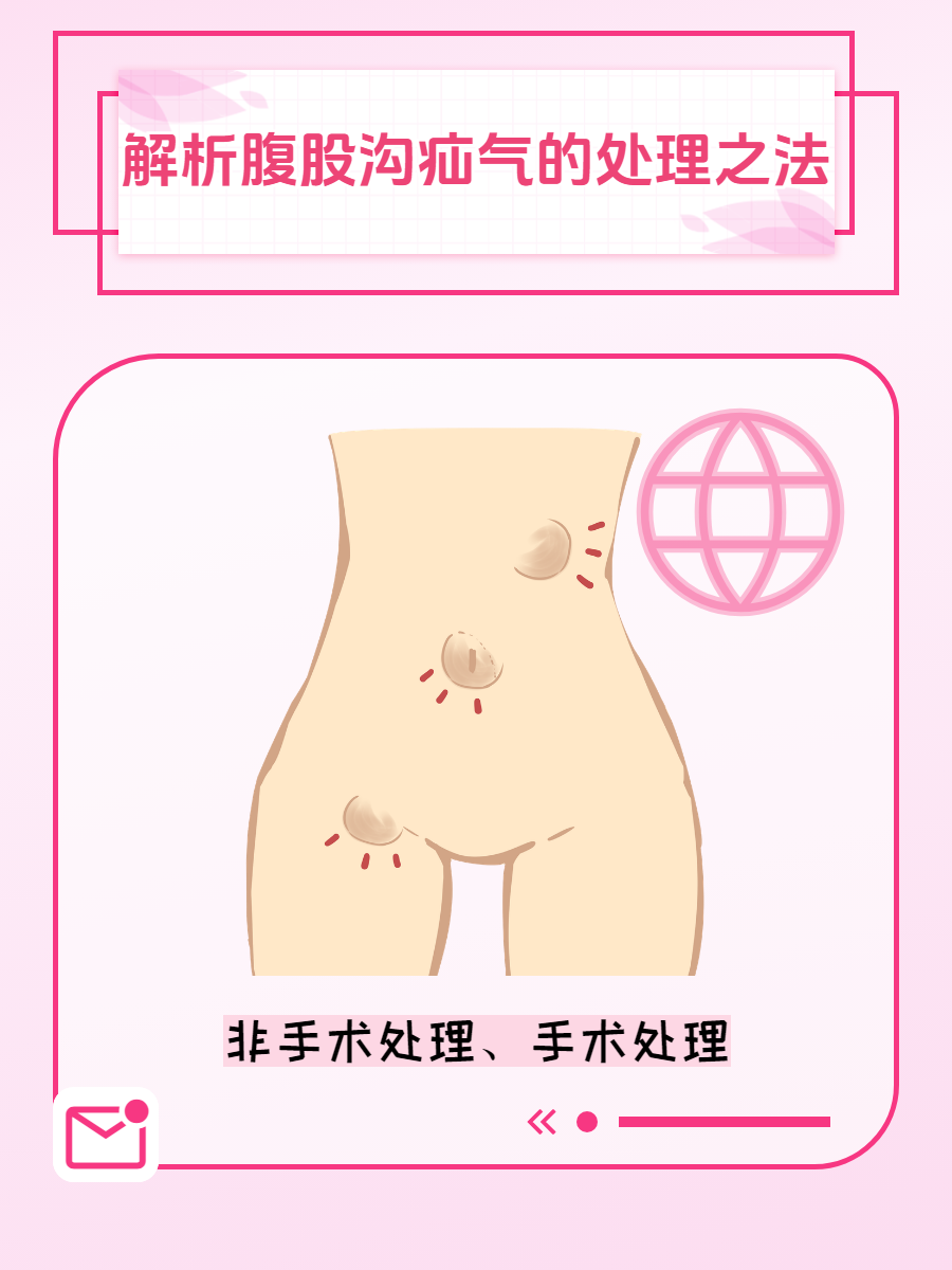 什么是腹股沟疝?