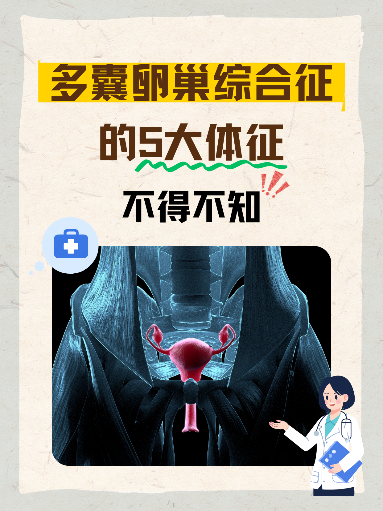 多囊卵巢综合征定义