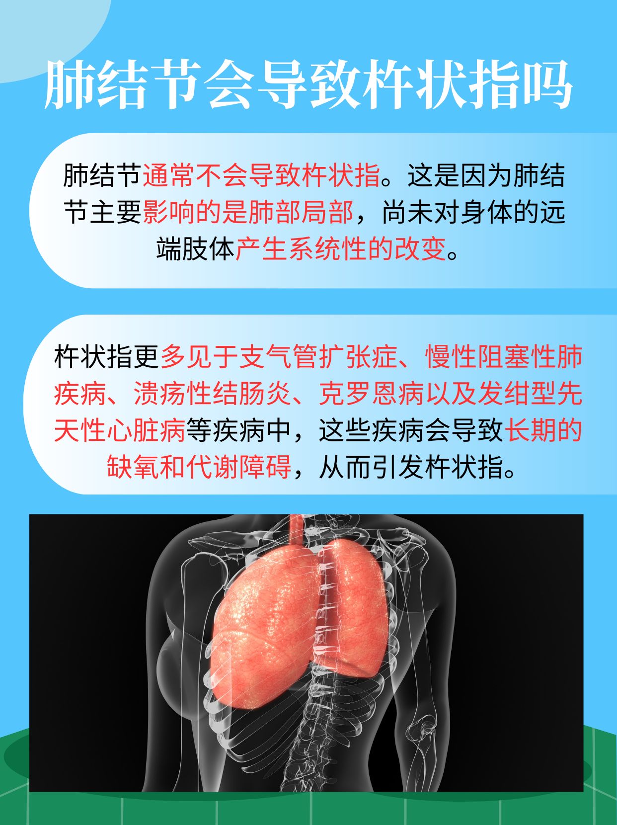 肺心病能治好吗