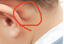 后脑勺正中间有一块凸起骨头怎么回事