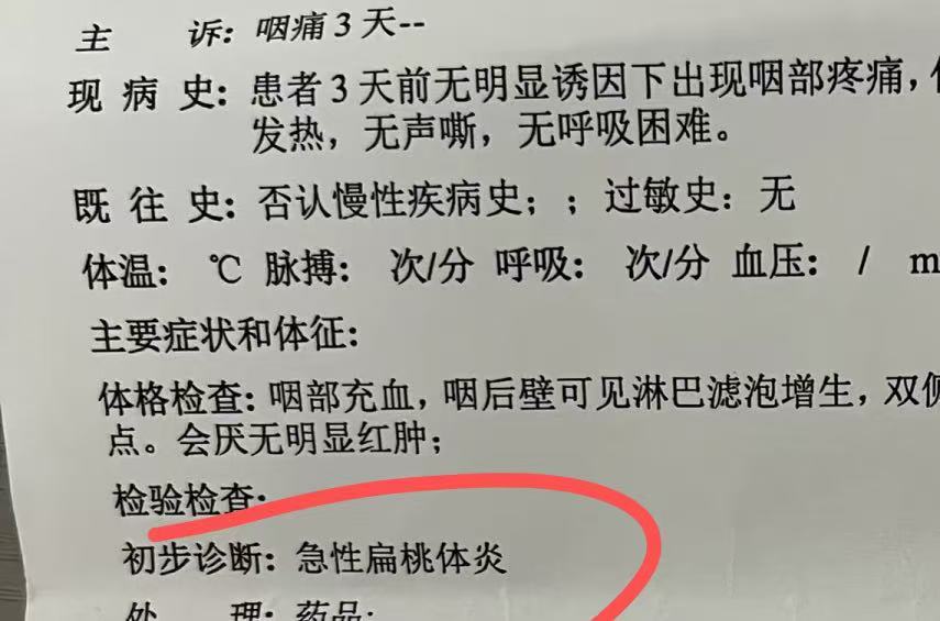 扁桃体发炎反复发烧一般要几天