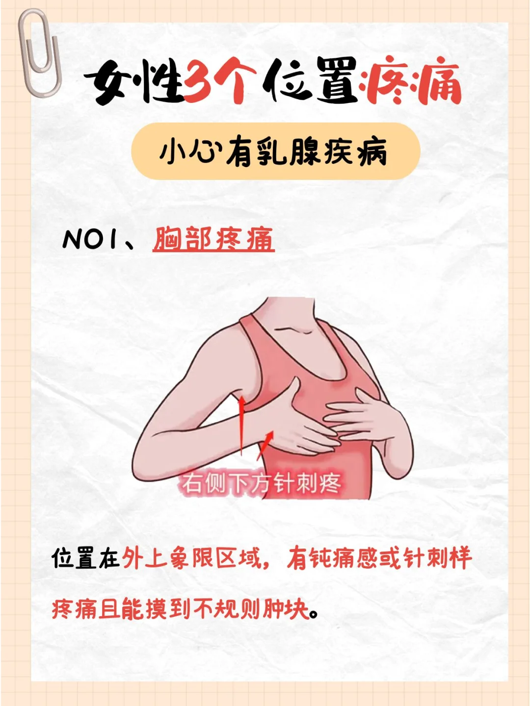 乳房痛挂什么科室