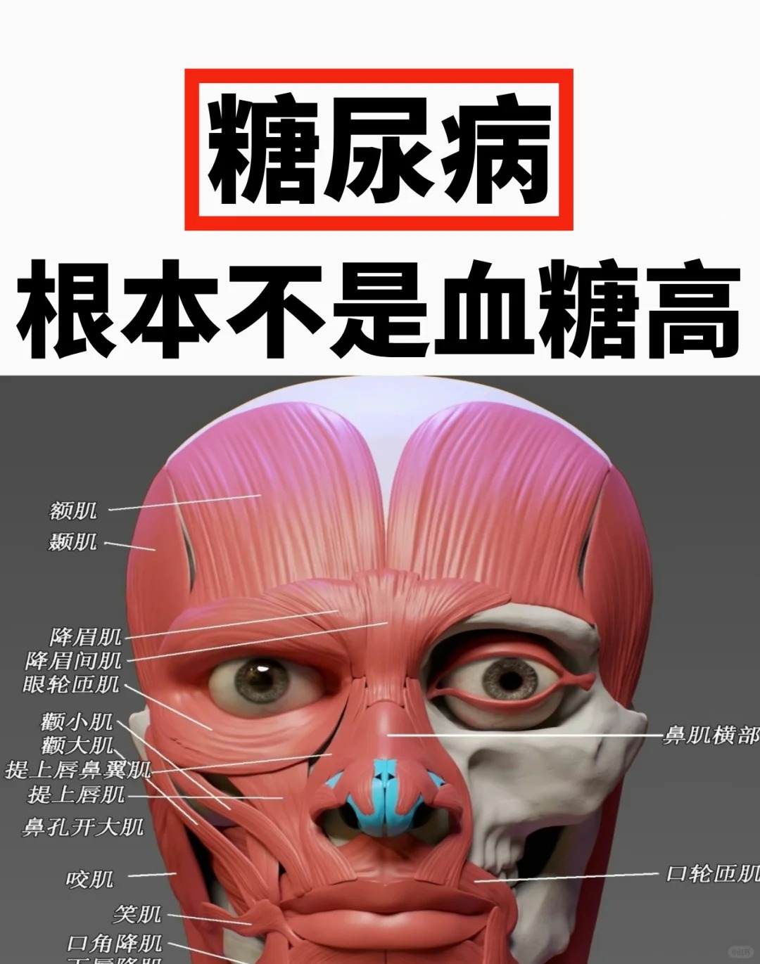 糖尿病是怎么引起的