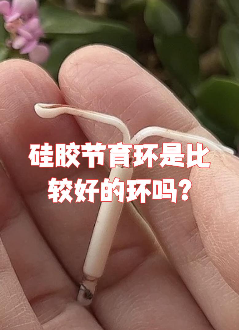 哪种避孕环最好