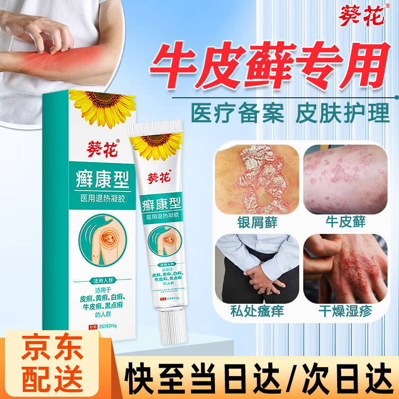 治疗银屑病的常用药膏