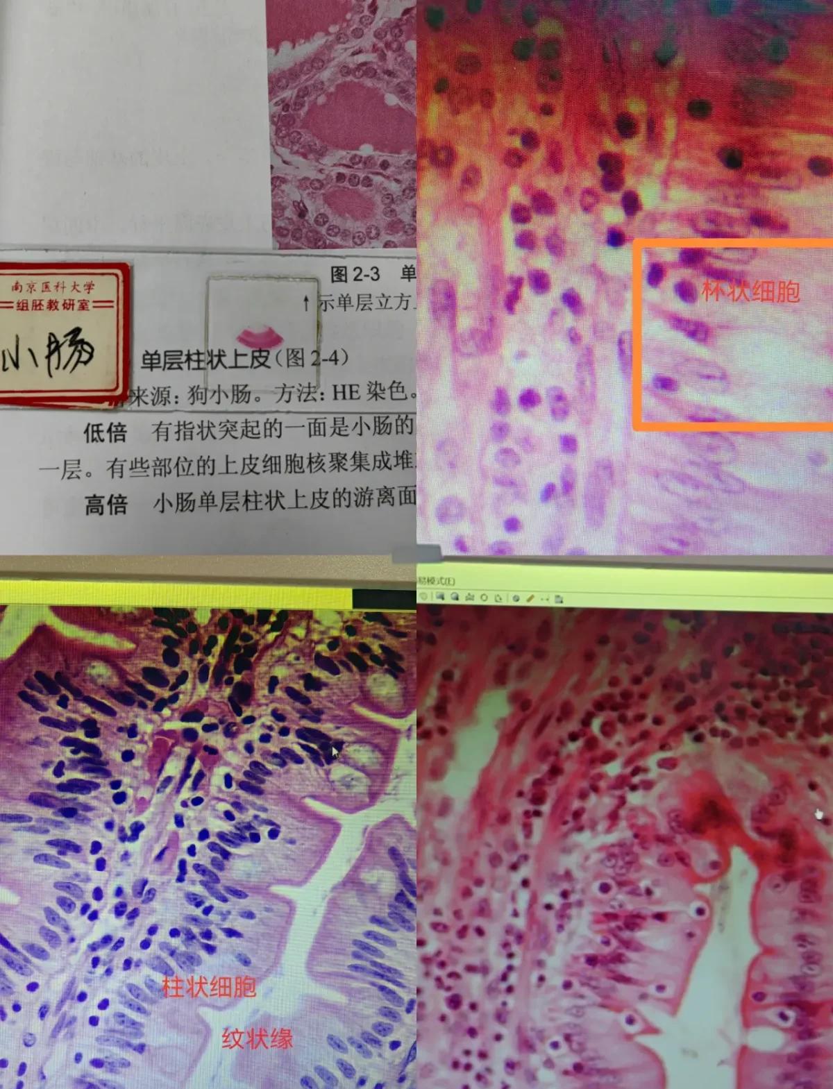 尿常规检查中上皮细胞是什么意思