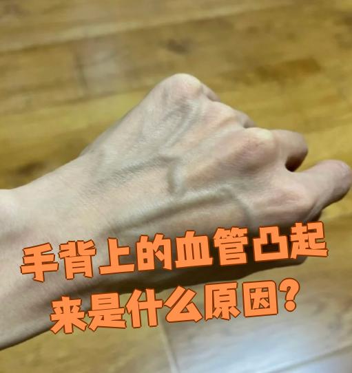 右手血管突然鼓了个小包,是什么原因