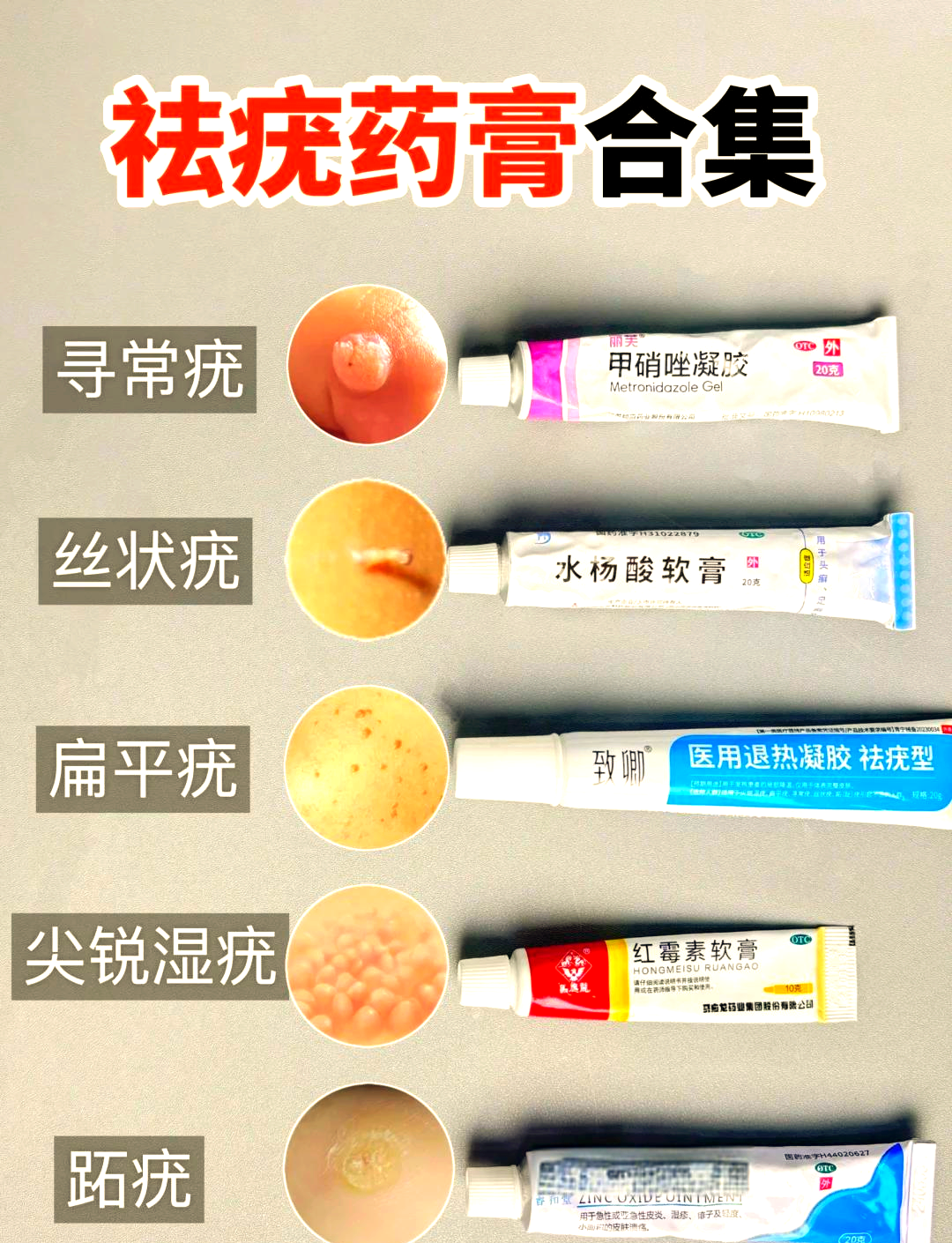 丝状疣用什么药膏最好