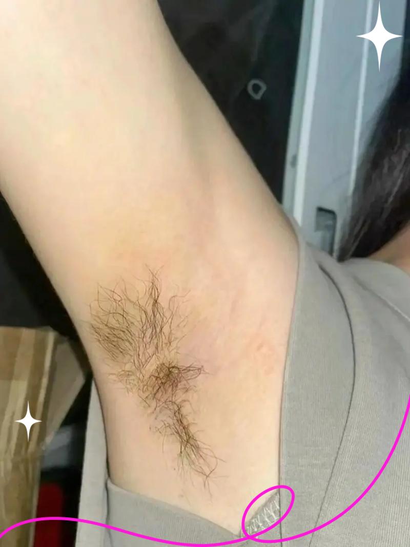 拔腋毛有什么危害吗