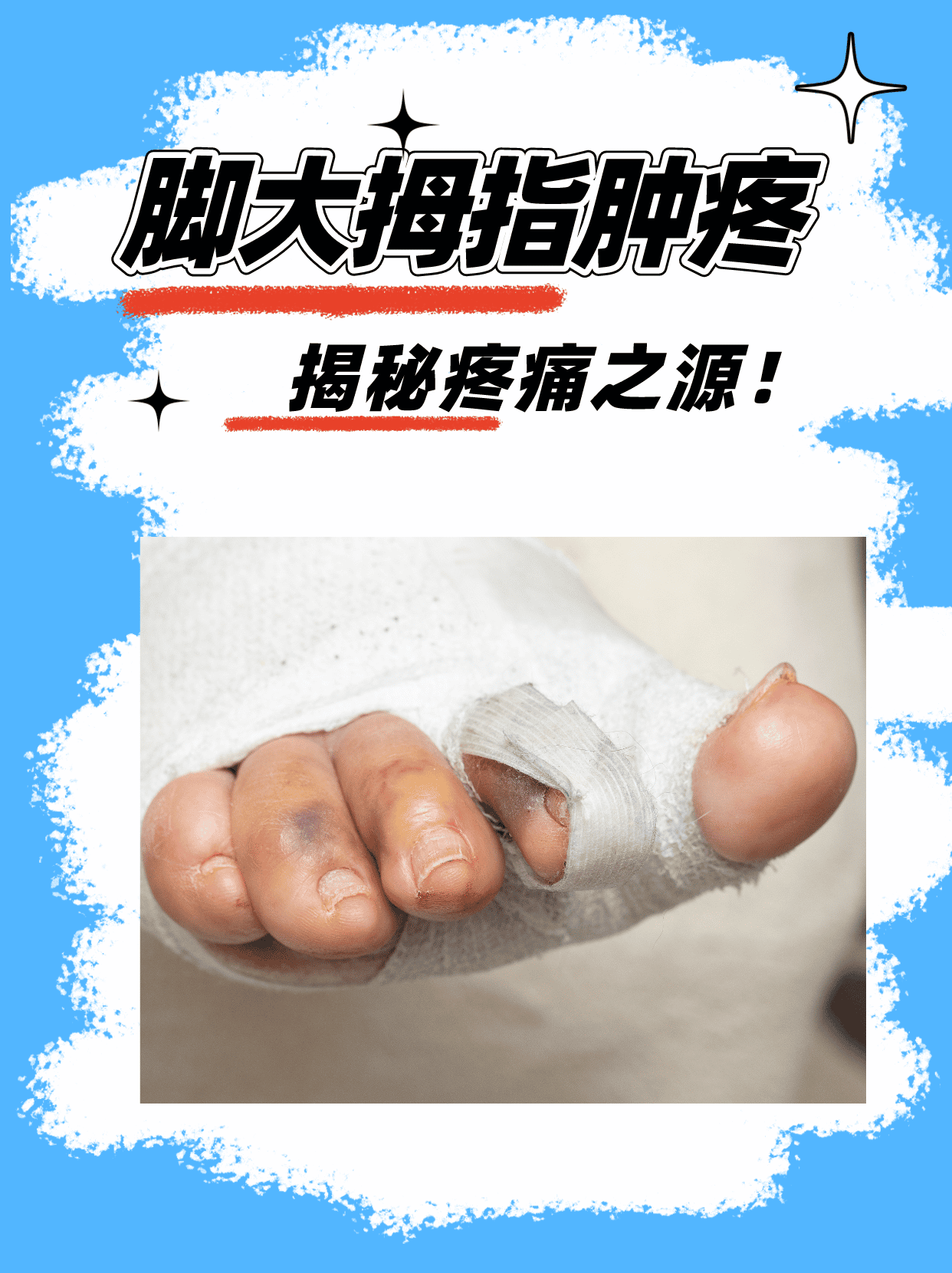 右脚大拇指发麻是怎么回事?