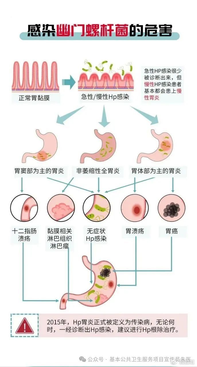 幽门螺杆菌感染的症状有哪些?