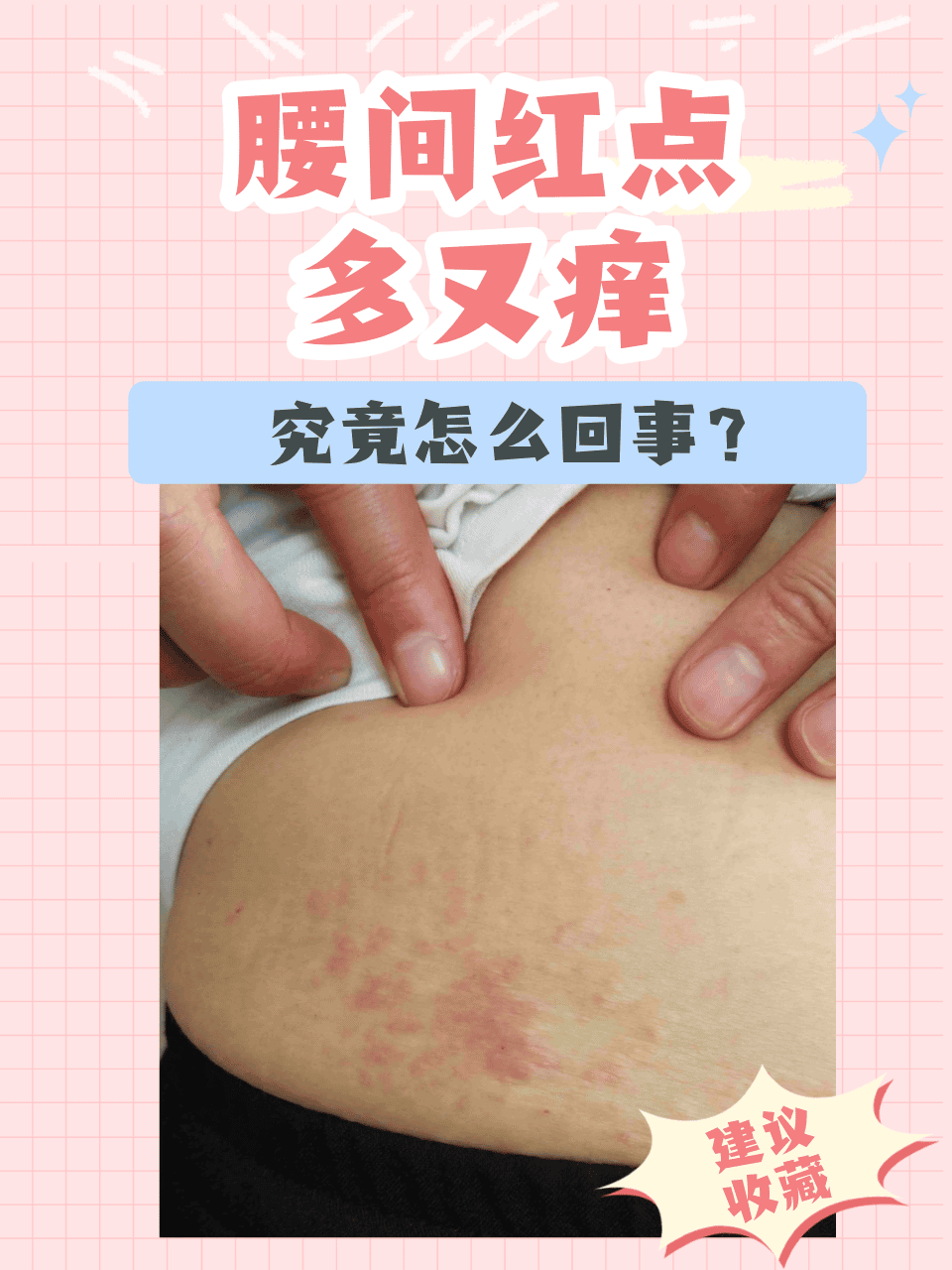 身上被蚊子叮咬的小红点怎么去除