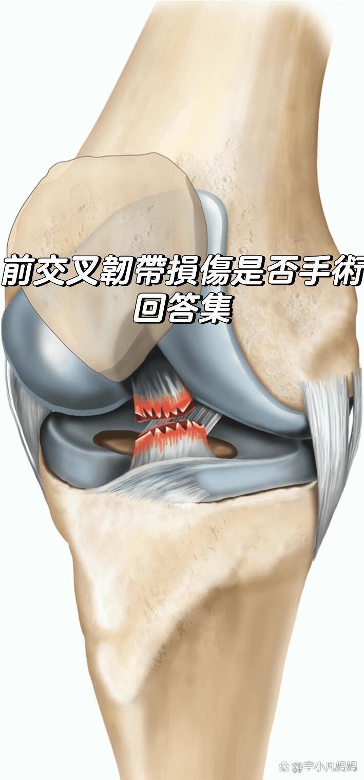 交叉韧带损伤多久能好