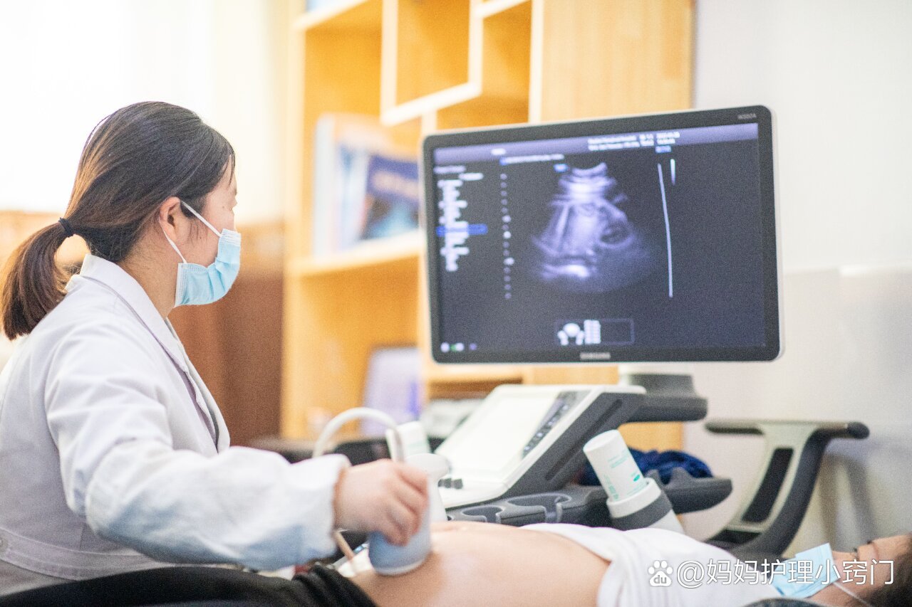 彩超是怎么检查的