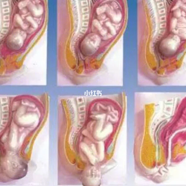 胎膜破裂是什么意思
