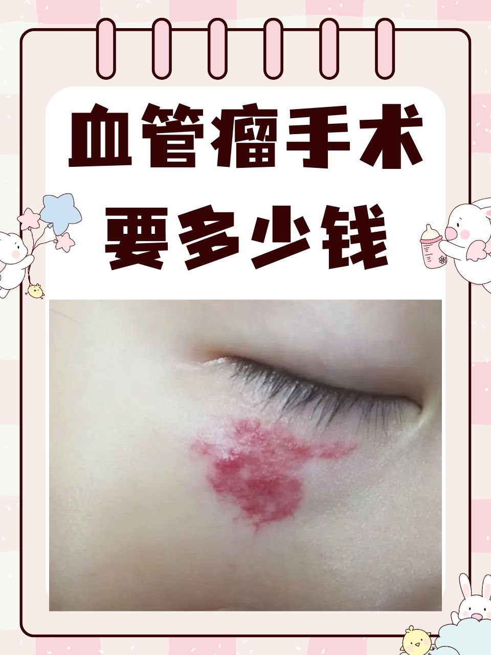 脑血管瘤是怎样的疾病怎样治疗