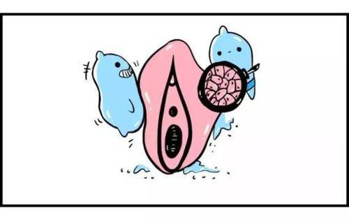 怎么治好外阴炎