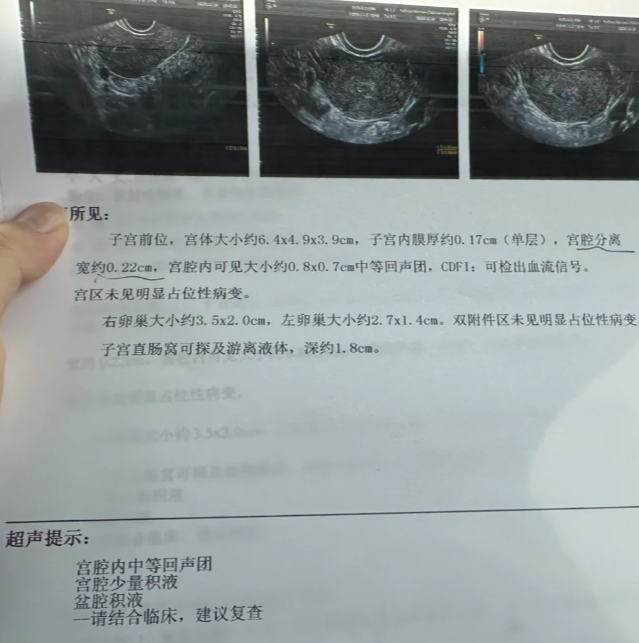 人流后一个月还没来月经正常吗