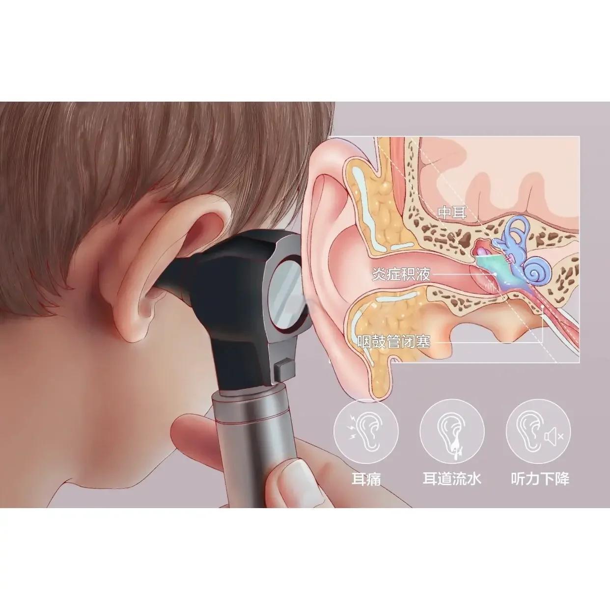 滴耳液如何治疗中耳炎？