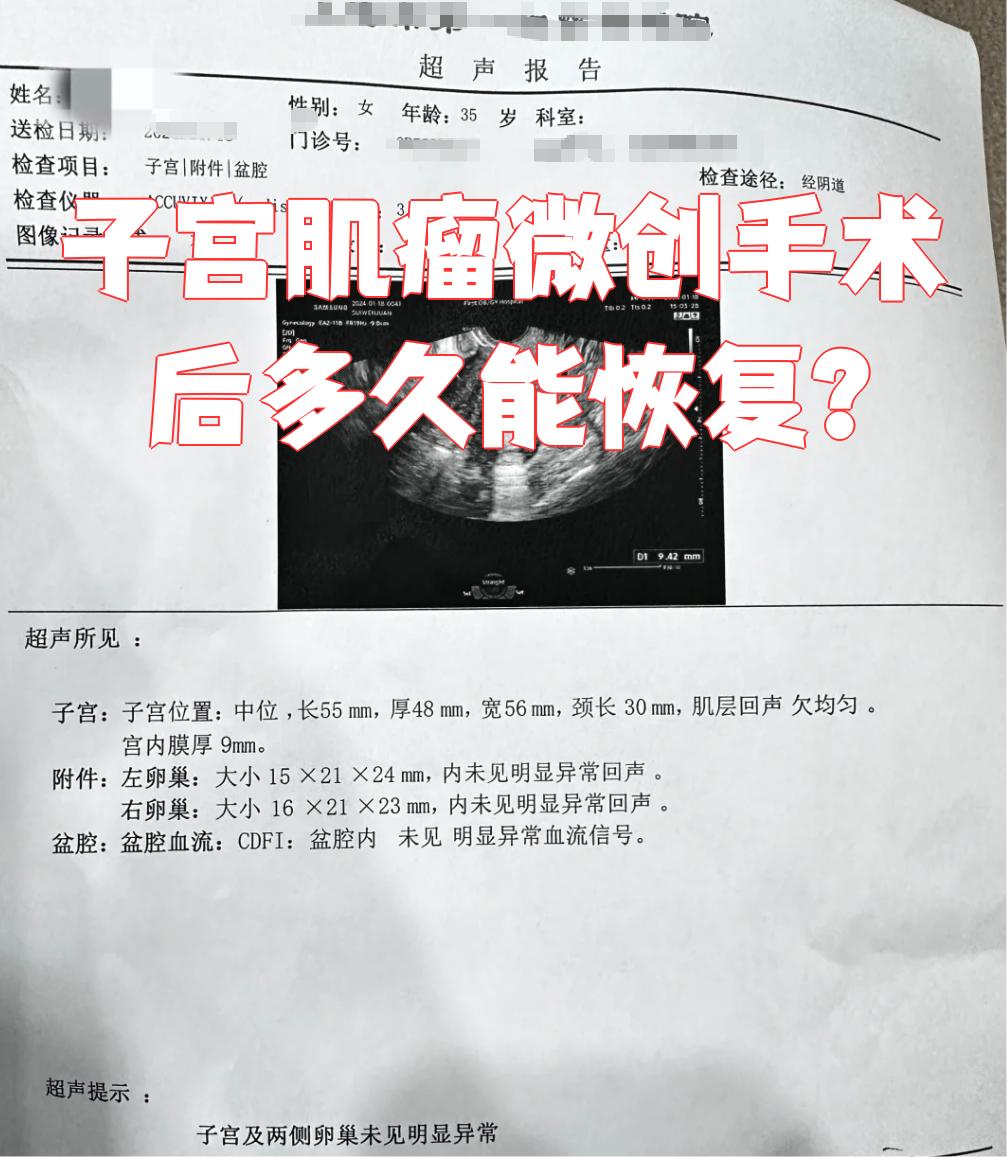 子宫肌瘤多大要做手术