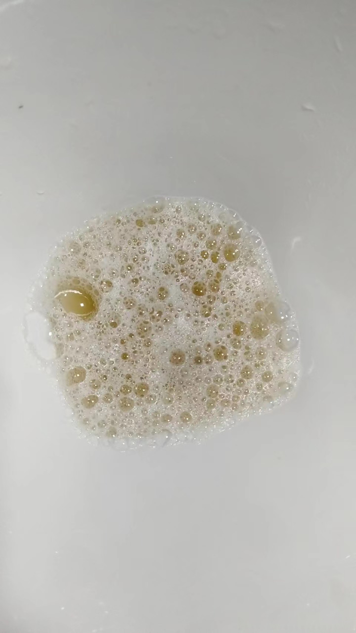 尿一开始是白色浑浊的