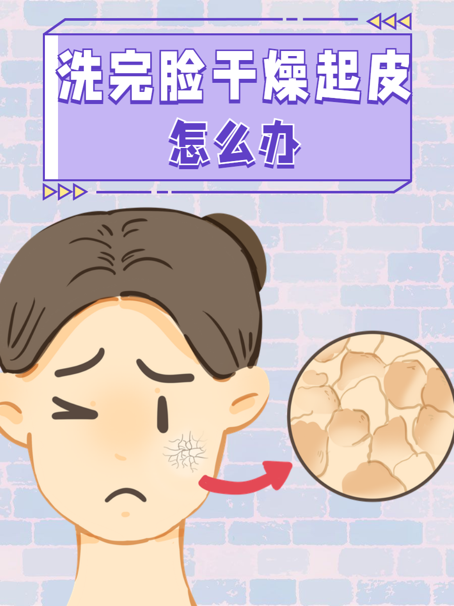 皮肤干燥怎么办?