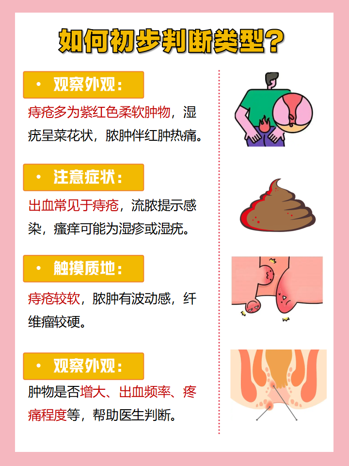 痔疮是由什么原因引起的?