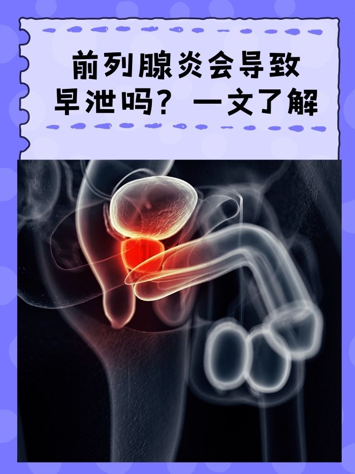 前列腺炎是什么,什么是前列腺炎