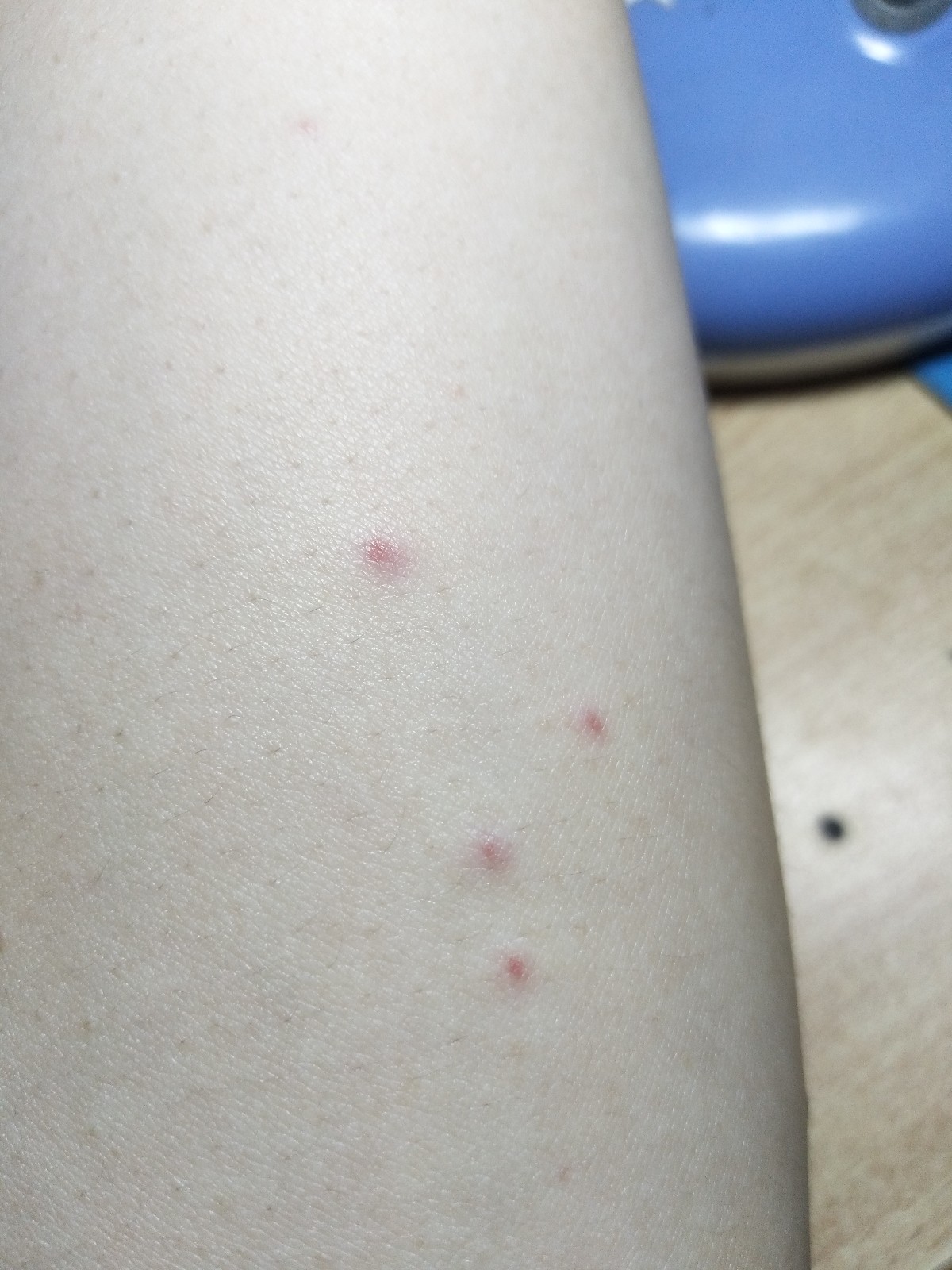 胳膊上有小红点不疼不痒