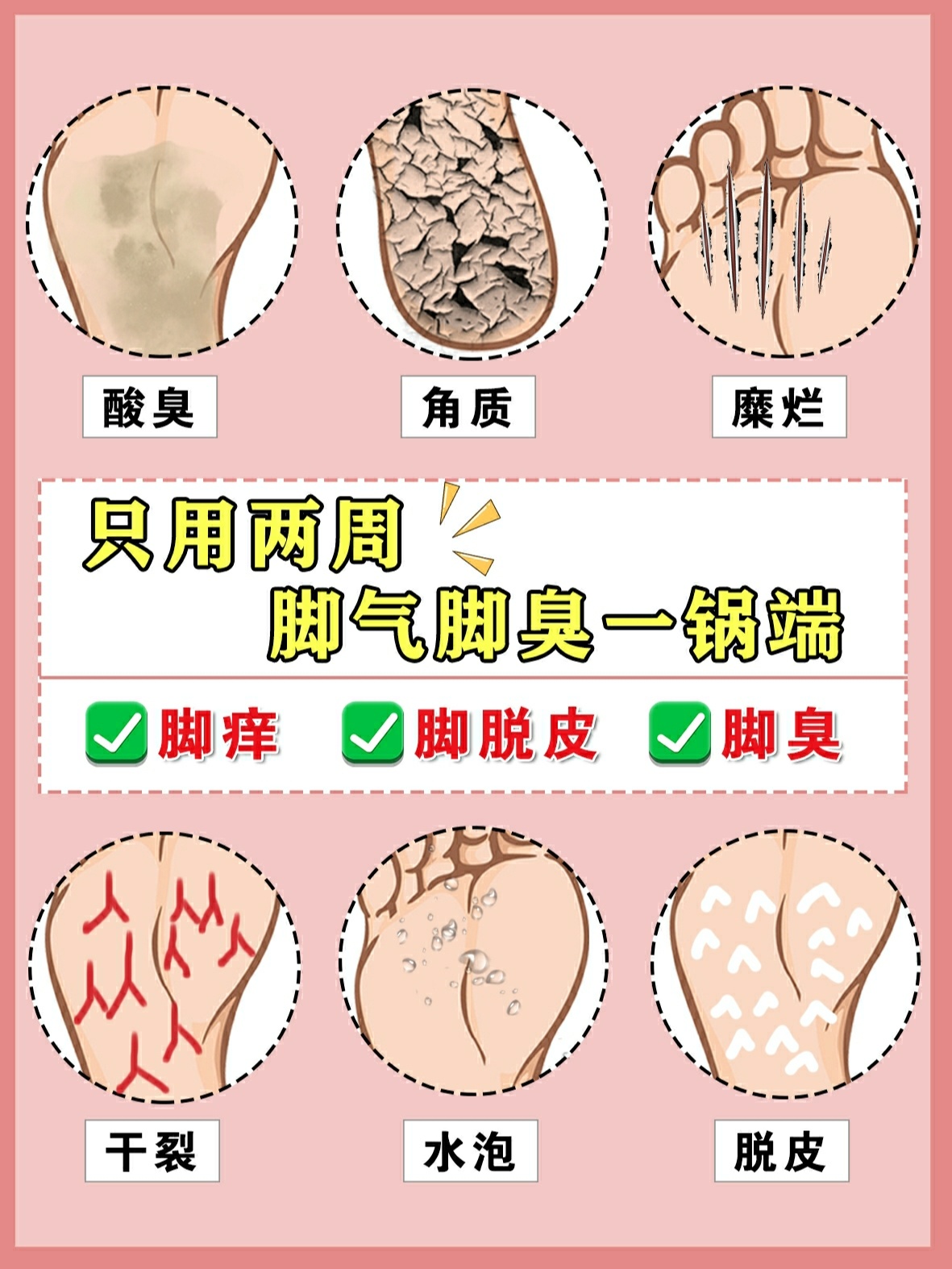 脚痒,脚掉皮怎么办?