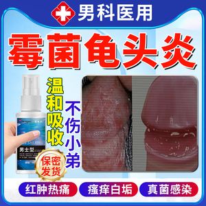 男性念珠菌感染用什么药治疗?