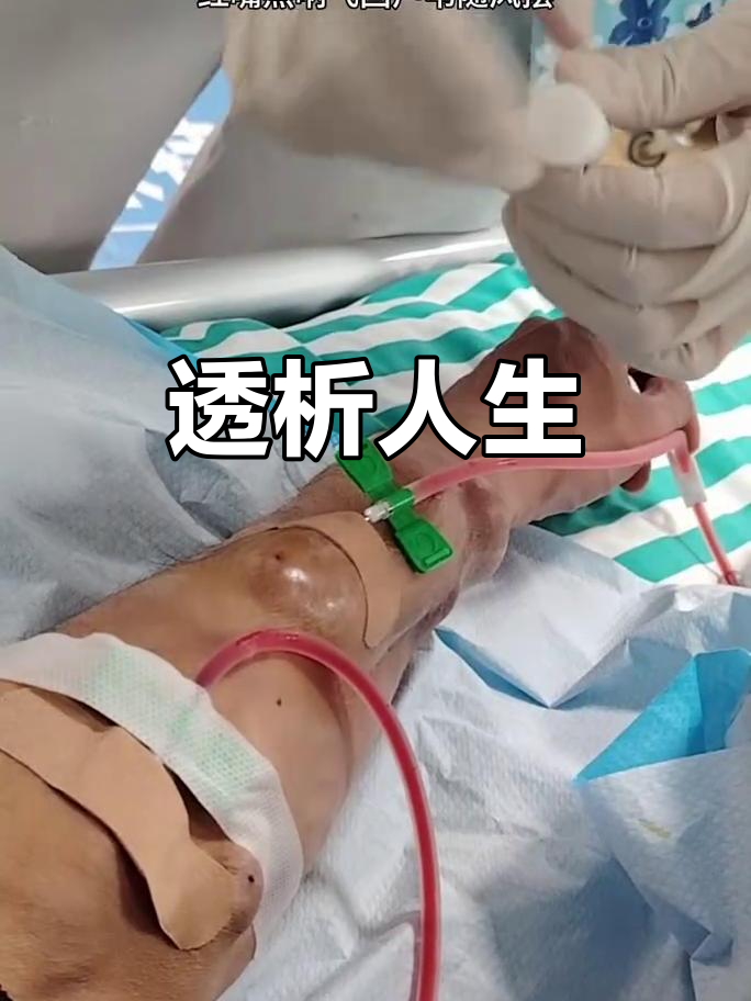 尿毒症晚期能活多久