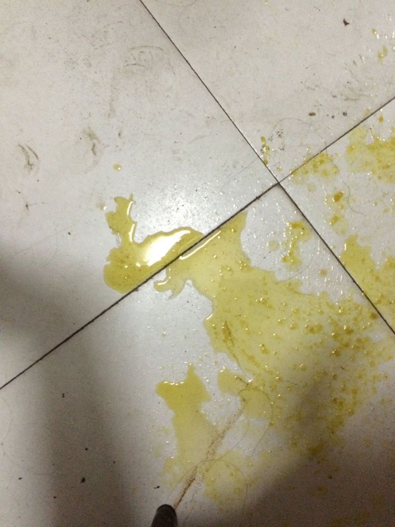 拉肚子拉了10多次,都是水