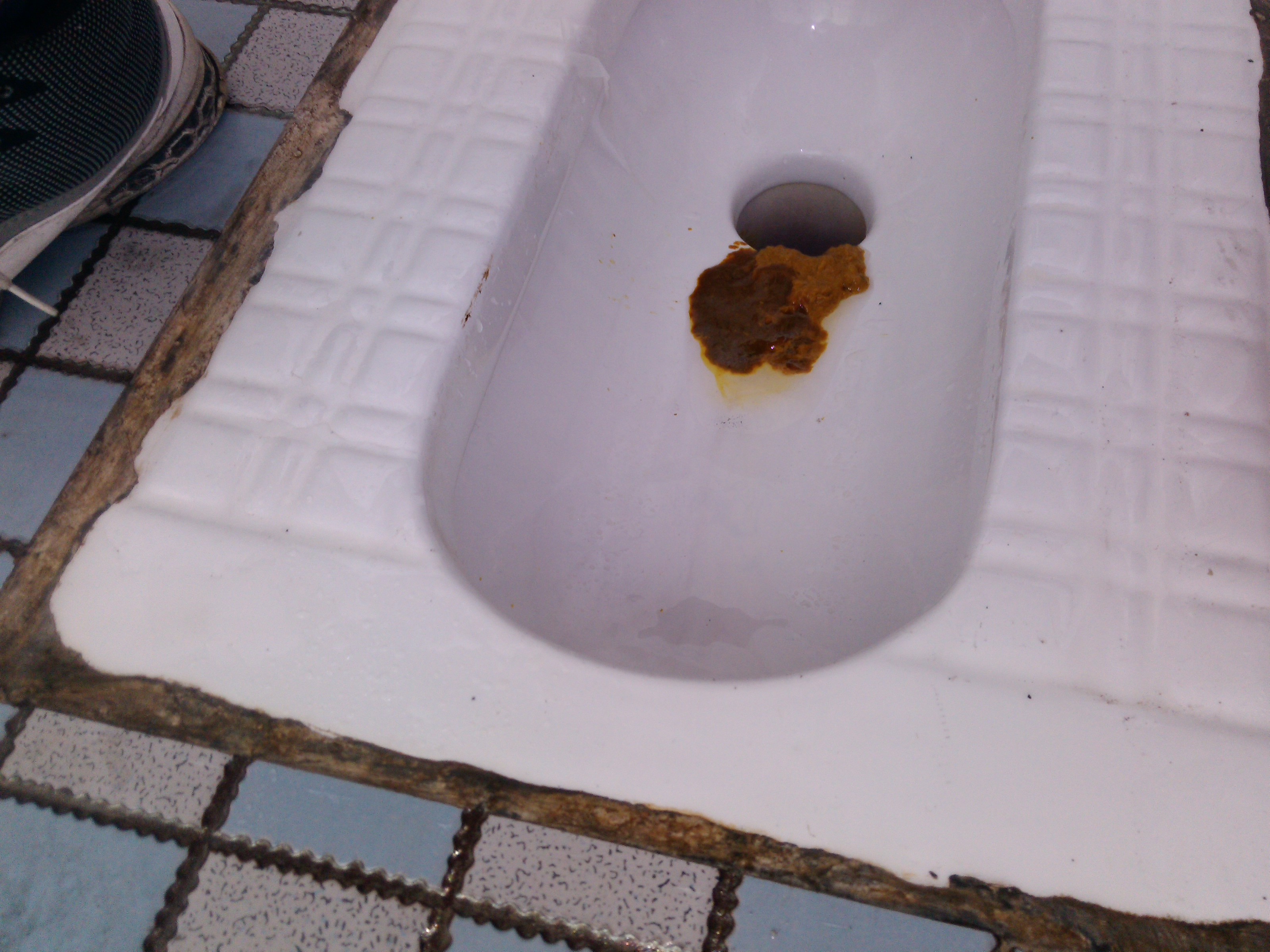 拉肚子拉了10多次,都是水