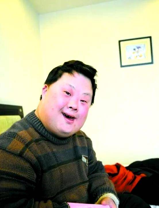 三体综合征是什么病