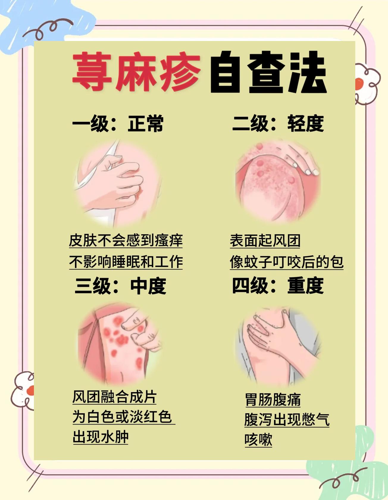 过敏性荨麻疹该怎么治疗?