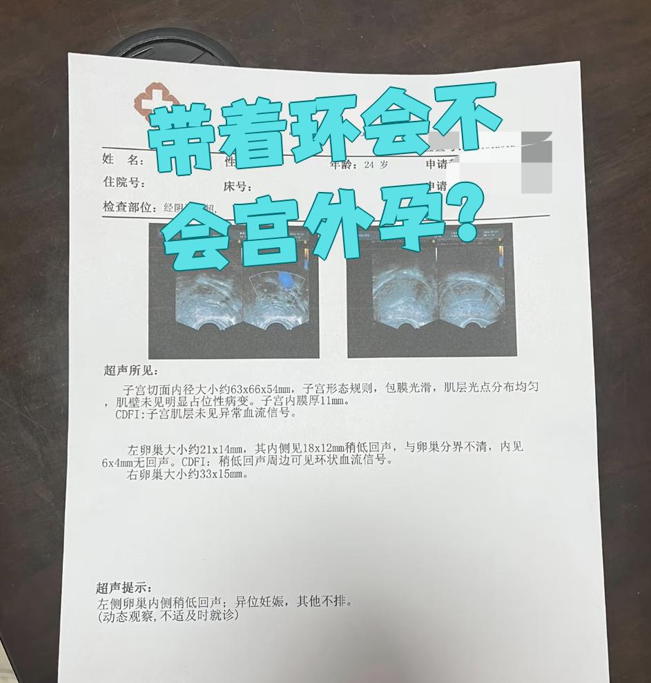 带环怀孕怎么办
