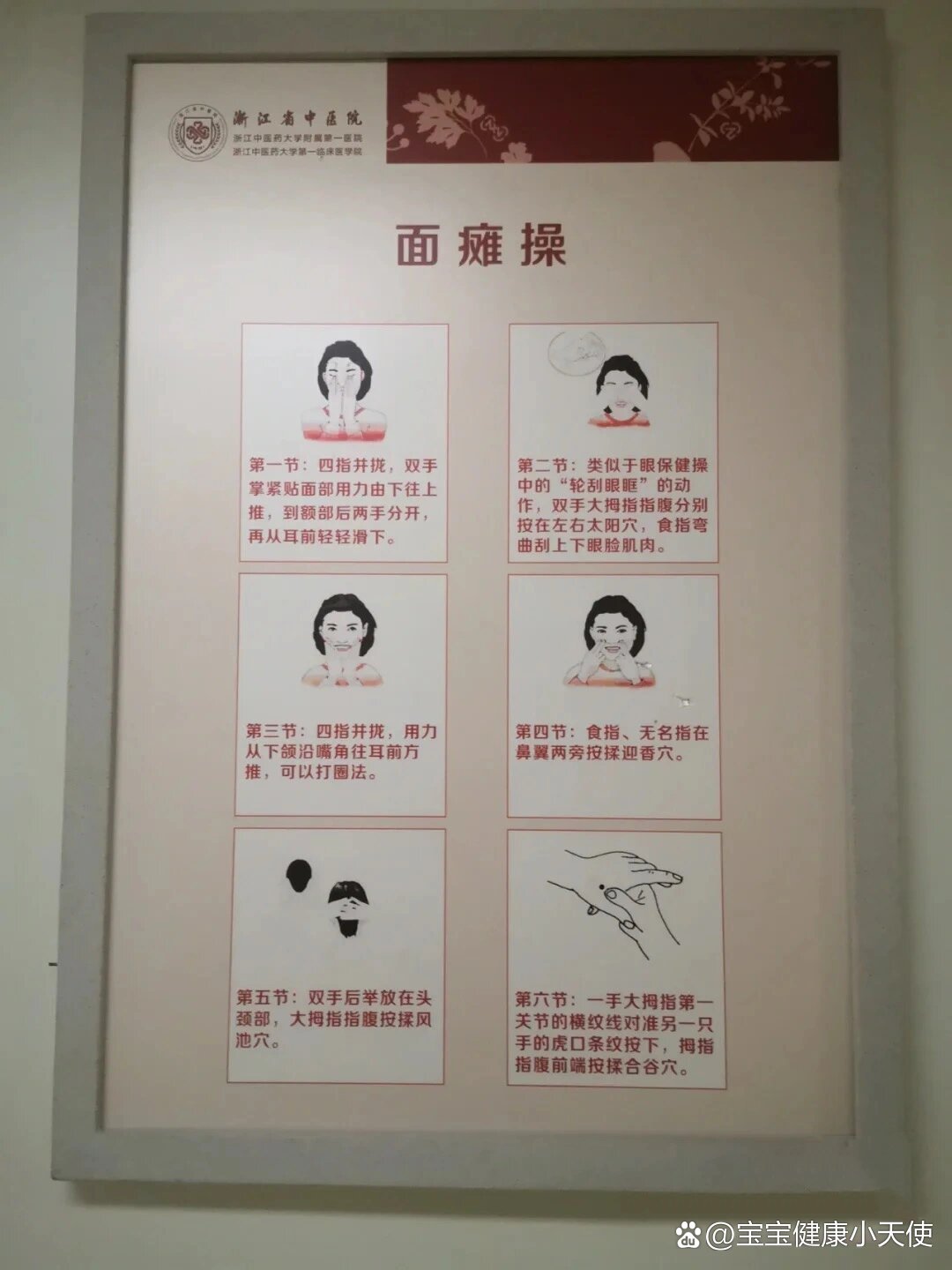 面瘫一般治疗多长时间?