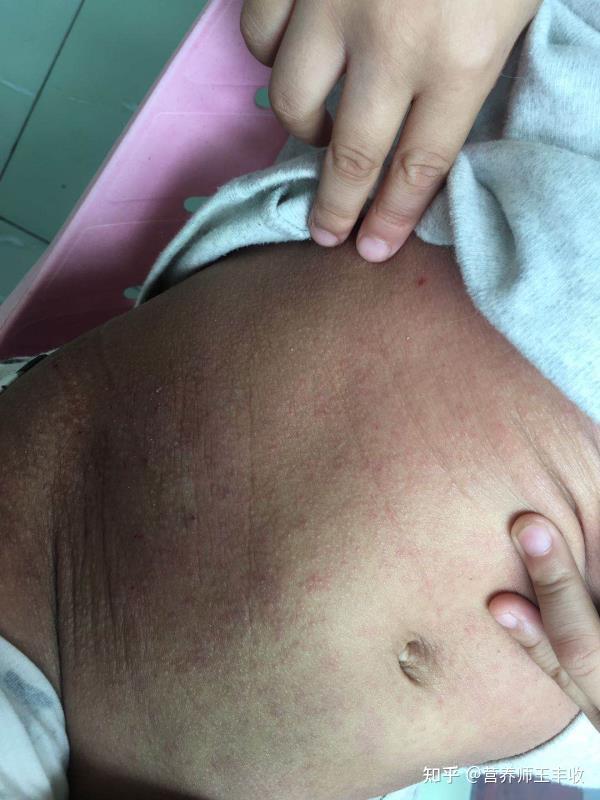 2025年12月23日 第11页