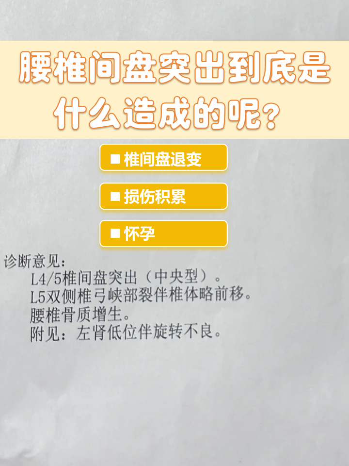 腰椎骨质增生严重吗