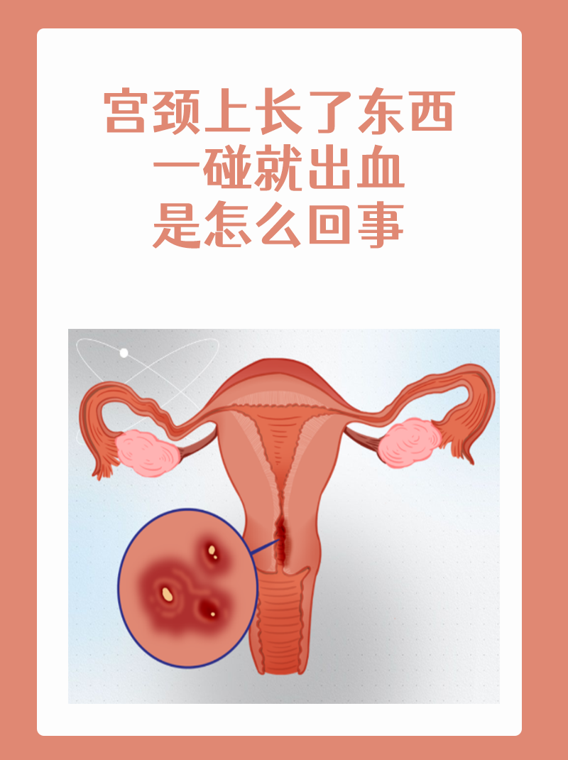 同房出血,该做什么检查