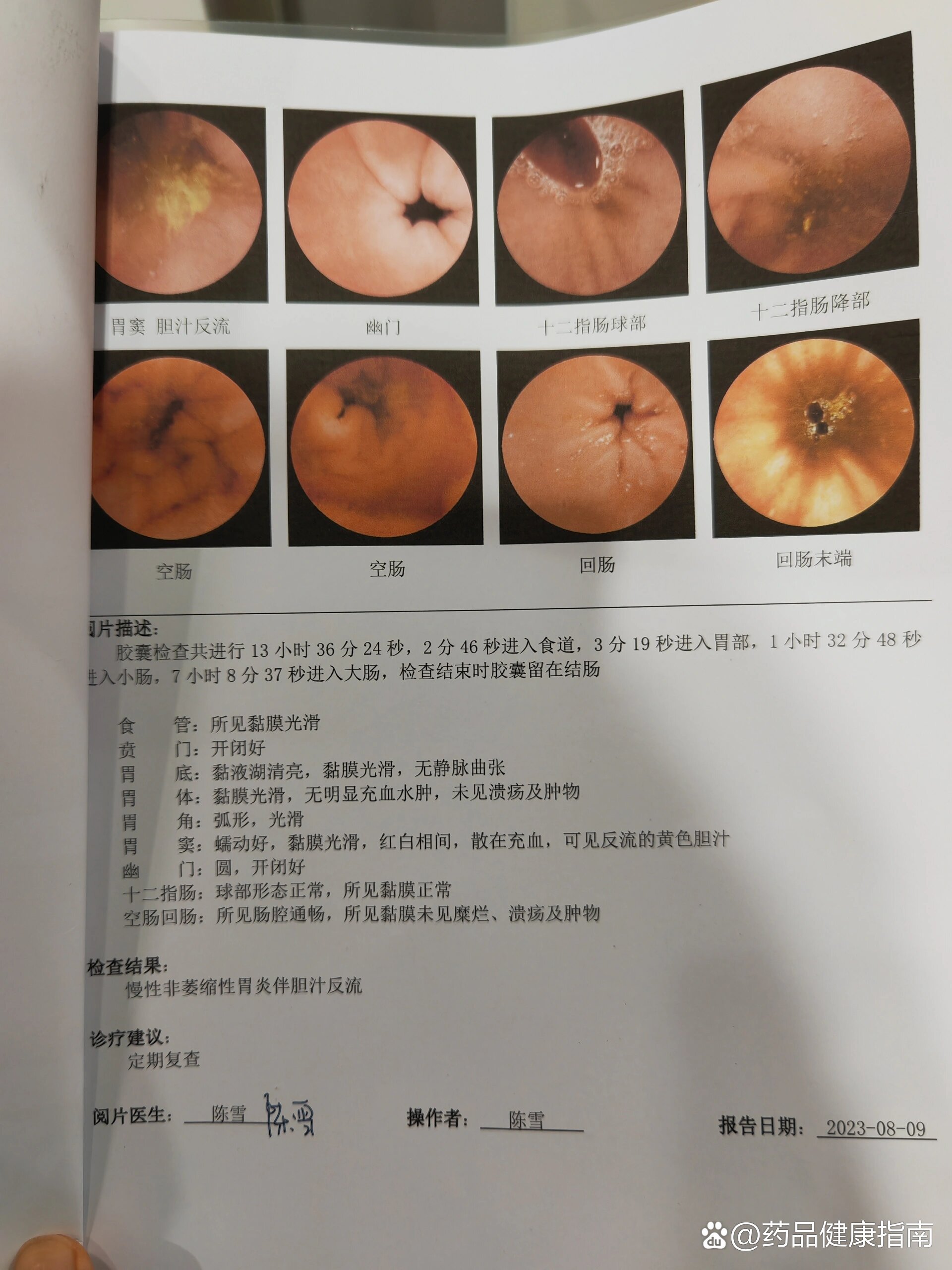 做胃镜一次多少钱