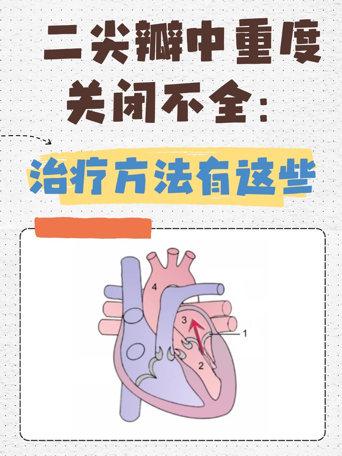 心脏扩大能治好吗